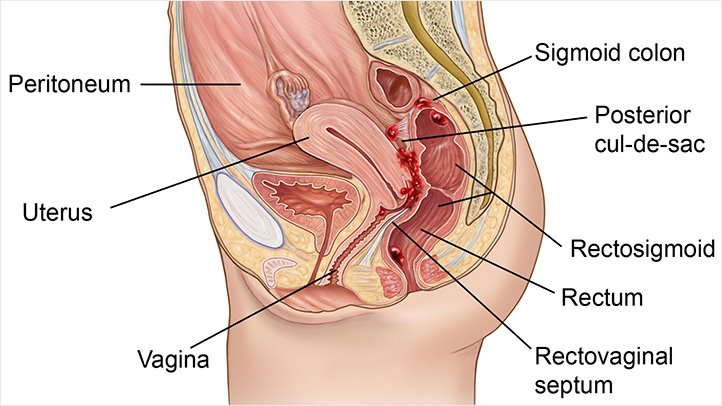 space between and rectum vagina
