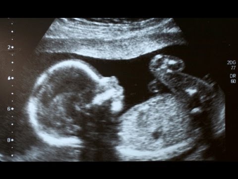 masturbation in the womb