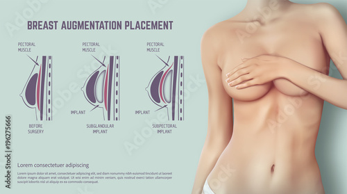 breast surgery breast implants facial augmentation